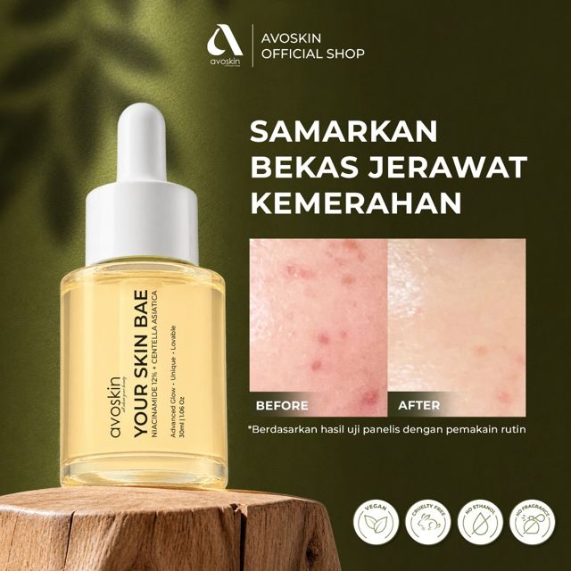AVOSKIN Your Skin Bae Niacinamide Serum 30ml 12% Niacinamide